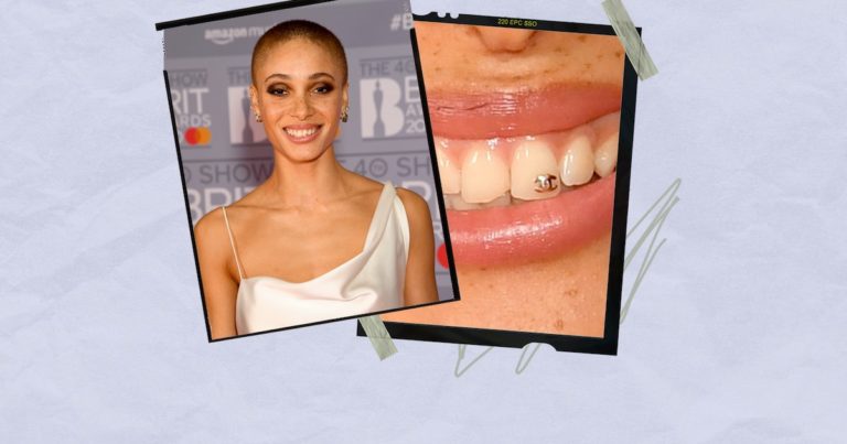 Are Tooth Gems Safe? Experts Comment On The TikTok Beauty Trend