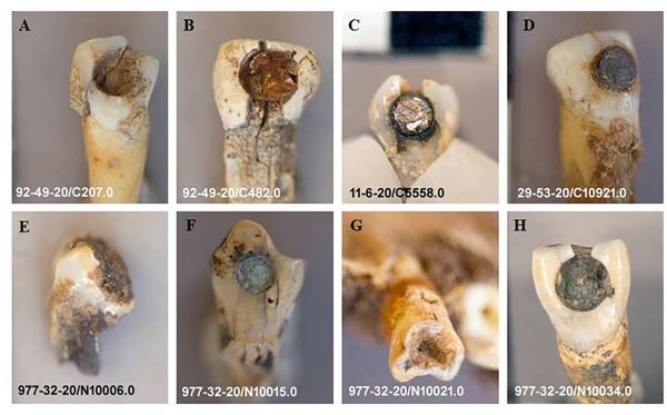 Historical Maya Follow of Gluing Gems Onto Tooth Might Have Been For Extra Than Bling : ScienceAlert