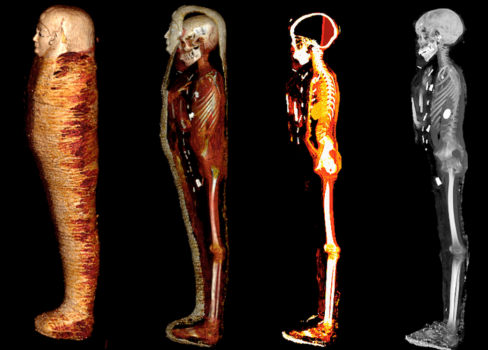 ‘Golden boy’ mummy was coated in ‘magic’ amulets, scan reveals